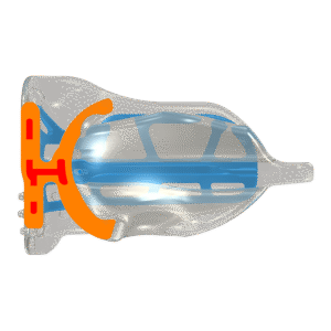 Myobrace T2 – Image 4